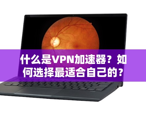 什么是VPN加速器?如何选择最适合自己的? 什么是VPN加速器?如何选择最适合自己的?